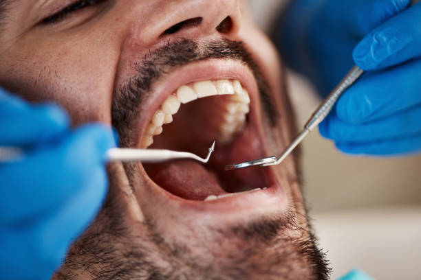 Best Walk-In Emergency Dentist in Lansing, MI