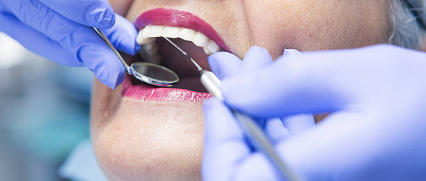 Best Emergency Treatment for Toothache in Lansing, MI